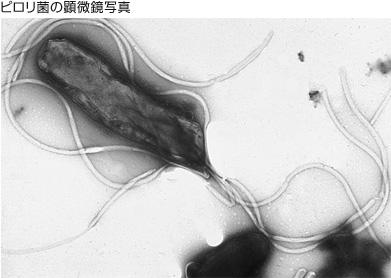 胃がん健診におけるピロリ菌顕微鏡写真