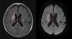 宇都宮記念病院のMRI・MRA検査の画像